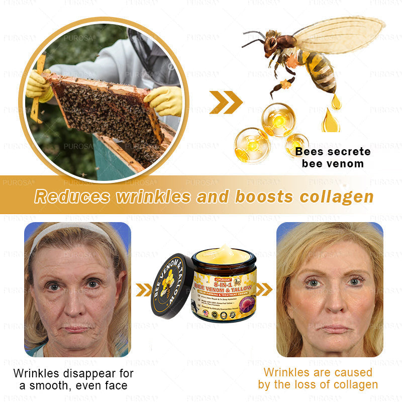 🌿𝐏𝐔𝐑𝐎𝐒𝐀® 8-𝑰𝒏-1 𝑩𝒆𝒆 𝑽𝒆𝒏𝒐𝒎 & 𝑻𝒂𝒍𝒍𝒐𝒘 𝑺𝒌𝒊𝒏 𝑭𝒊𝒓𝒎𝒊𝒏𝒈 & 𝑻𝒓𝒆𝒂𝒕𝒎𝒆𝒏𝒕 𝑪𝒓𝒆𝒂𝒎 Anti-aging, Hydrating, Skin Repair, Even Tone, Acne and Dark Spot Treatment, Wart and Mole Removal, Psoriasis Relief