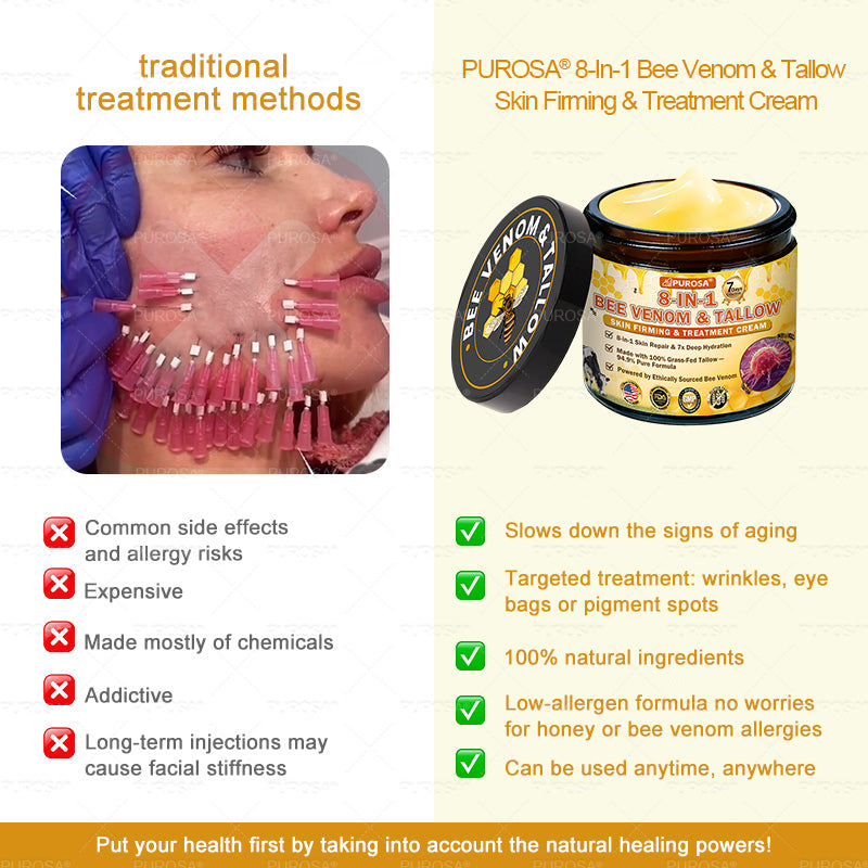🌿𝐏𝐔𝐑𝐎𝐒𝐀® 8-𝑰𝒏-1 𝑩𝒆𝒆 𝑽𝒆𝒏𝒐𝒎 & 𝑻𝒂𝒍𝒍𝒐𝒘 𝑺𝒌𝒊𝒏 𝑭𝒊𝒓𝒎𝒊𝒏𝒈 & 𝑻𝒓𝒆𝒂𝒕𝒎𝒆𝒏𝒕 𝑪𝒓𝒆𝒂𝒎 Anti-aging, Hydrating, Skin Repair, Even Tone, Acne and Dark Spot Treatment, Wart and Mole Removal, Psoriasis Relief