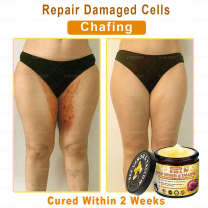 🌿𝐏𝐔𝐑𝐎𝐒𝐀® 8-𝑰𝒏-1 𝑩𝒆𝒆 𝑽𝒆𝒏𝒐𝒎 & 𝑻𝒂𝒍𝒍𝒐𝒘 𝑺𝒌𝒊𝒏 𝑭𝒊𝒓𝒎𝒊𝒏𝒈 & 𝑻𝒓𝒆𝒂𝒕𝒎𝒆𝒏𝒕 𝑪𝒓𝒆𝒂𝒎 Anti-aging, Hydrating, Skin Repair, Even Tone, Acne and Dark Spot Treatment, Wart and Mole Removal, Psoriasis Relief