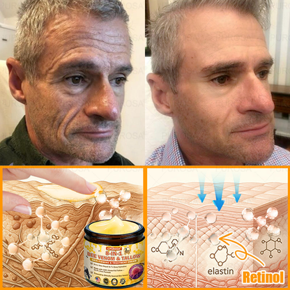 🐝🐝🐝𝗣𝗨𝗥𝗢𝗦𝗔® 𝟖-𝐈𝐧-𝟏 𝐁𝐞𝐞 𝐕𝐞𝐧𝐨𝐦 & 𝐓𝐚𝐥𝐥𝐨𝐰 𝐒𝐤𝐢𝐧 𝐅𝐢𝐫𝐦𝐢𝐧𝐠 & 𝐓𝐫𝐞𝐚𝐭𝐦𝐞𝐧𝐭 𝐂𝐫𝐞𝐚𝐦 (Effective Within 7 Days)Bee Venom + Tallow · 7X Deep Hydration, targets wrinkles, sagging, stretch marks, dark spots, purpura, inflammations and more