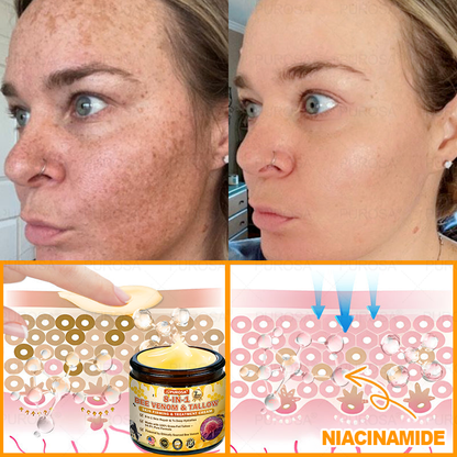 🐝🐝🐝𝗣𝗨𝗥𝗢𝗦𝗔® 𝟖-𝐈𝐧-𝟏 𝐁𝐞𝐞 𝐕𝐞𝐧𝐨𝐦 & 𝐓𝐚𝐥𝐥𝐨𝐰 𝐒𝐤𝐢𝐧 𝐅𝐢𝐫𝐦𝐢𝐧𝐠 & 𝐓𝐫𝐞𝐚𝐭𝐦𝐞𝐧𝐭 𝐂𝐫𝐞𝐚𝐦 (Effective Within 7 Days)Bee Venom + Tallow · 7X Deep Hydration, targets wrinkles, sagging, stretch marks, dark spots, purpura, inflammations and more