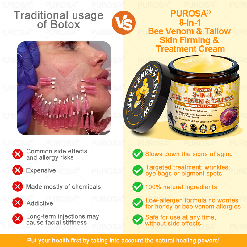 🐝🐝🐝𝗣𝗨𝗥𝗢𝗦𝗔® 𝟖-𝐈𝐧-𝟏 𝐁𝐞𝐞 𝐕𝐞𝐧𝐨𝐦 & 𝐓𝐚𝐥𝐥𝐨𝐰 𝐒𝐤𝐢𝐧 𝐅𝐢𝐫𝐦𝐢𝐧𝐠 & 𝐓𝐫𝐞𝐚𝐭𝐦𝐞𝐧𝐭 𝐂𝐫𝐞𝐚𝐦 (Effective Within 7 Days)Bee Venom + Tallow · 7X Deep Hydration, targets wrinkles, sagging, stretch marks, dark spots, purpura, inflammations and more