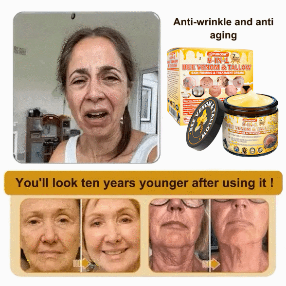 🌿𝐏𝐔𝐑𝐎𝐒𝐀® 8-𝑰𝒏-1 𝑩𝒆𝒆 𝑽𝒆𝒏𝒐𝒎 & 𝑻𝒂𝒍𝒍𝒐𝒘 𝑺𝒌𝒊𝒏 𝑭𝒊𝒓𝒎𝒊𝒏𝒈 & 𝑻𝒓𝒆𝒂𝒕𝒎𝒆𝒏𝒕 𝑪𝒓𝒆𝒂𝒎 Anti-aging, Hydrating, Skin Repair, Even Tone, Acne and Dark Spot Treatment, Wart and Mole Removal, Psoriasis Relief