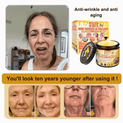 🌿𝐏𝐔𝐑𝐎𝐒𝐀® 8-𝑰𝒏-1 𝑩𝒆𝒆 𝑽𝒆𝒏𝒐𝒎 & 𝑻𝒂𝒍𝒍𝒐𝒘 𝑺𝒌𝒊𝒏 𝑭𝒊𝒓𝒎𝒊𝒏𝒈 & 𝑻𝒓𝒆𝒂𝒕𝒎𝒆𝒏𝒕 𝑪𝒓𝒆𝒂𝒎 Anti-aging, Hydrating, Skin Repair, Even Tone, Acne and Dark Spot Treatment, Wart and Mole Removal, Psoriasis Relief