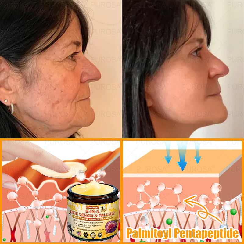 🐝🐝🐝𝗣𝗨𝗥𝗢𝗦𝗔® 𝟖-𝐈𝐧-𝟏 𝐁𝐞𝐞 𝐕𝐞𝐧𝐨𝐦 & 𝐓𝐚𝐥𝐥𝐨𝐰 𝐒𝐤𝐢𝐧 𝐅𝐢𝐫𝐦𝐢𝐧𝐠 & 𝐓𝐫𝐞𝐚𝐭𝐦𝐞𝐧𝐭 𝐂𝐫𝐞𝐚𝐦 (Effective Within 7 Days)Bee Venom + Tallow · 7X Deep Hydration, targets wrinkles, sagging, stretch marks, dark spots, purpura, inflammations and more