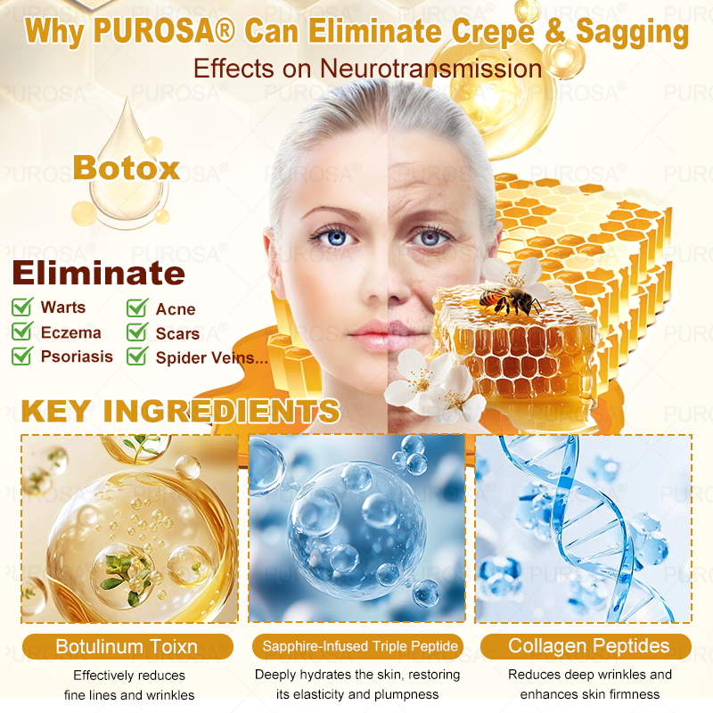 🐝🐝🐝𝗣𝗨𝗥𝗢𝗦𝗔® 𝟖-𝐈𝐧-𝟏 𝐁𝐞𝐞 𝐕𝐞𝐧𝐨𝐦 & 𝐓𝐚𝐥𝐥𝐨𝐰 𝐒𝐤𝐢𝐧 𝐅𝐢𝐫𝐦𝐢𝐧𝐠 & 𝐓𝐫𝐞𝐚𝐭𝐦𝐞𝐧𝐭 𝐂𝐫𝐞𝐚𝐦 (Effective Within 7 Days)Bee Venom + Tallow · 7X Deep Hydration, targets wrinkles, sagging, stretch marks, dark spots, purpura, inflammations and more